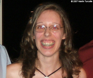 Marie-Hélène Cyr - Avant des chirurgies orthognatiques (8 septembre 2007)
